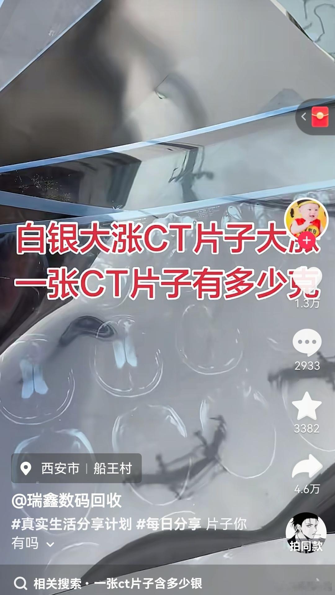 这个CT片子得确含银，不过，现在很多医院已经转数字化了。不然，白银这么涨，这片子