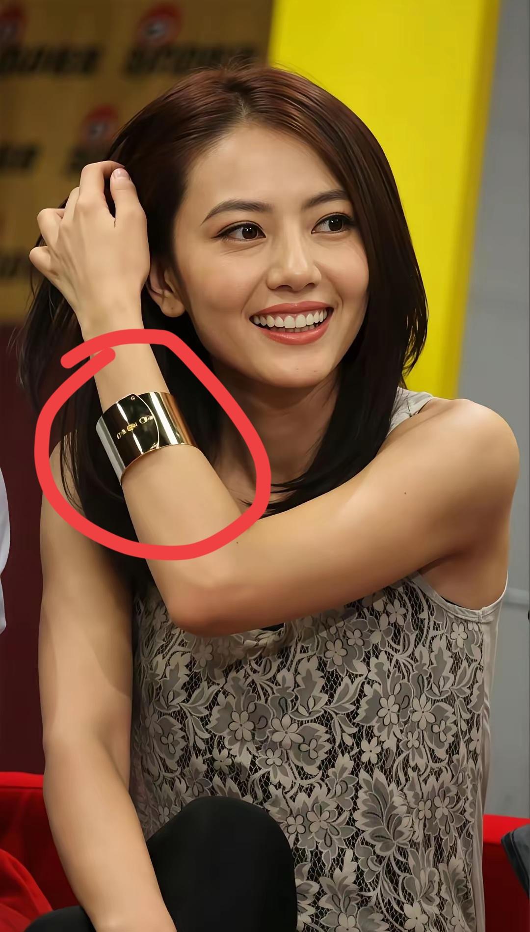 高圆圆手臂戴的是什么东西？