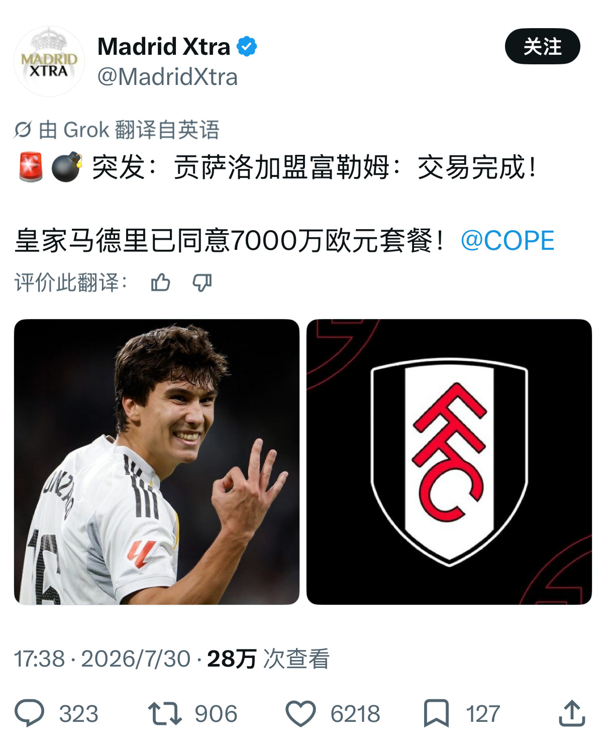 以后给孩子取名就叫贡萨洛，贡家人值钱 