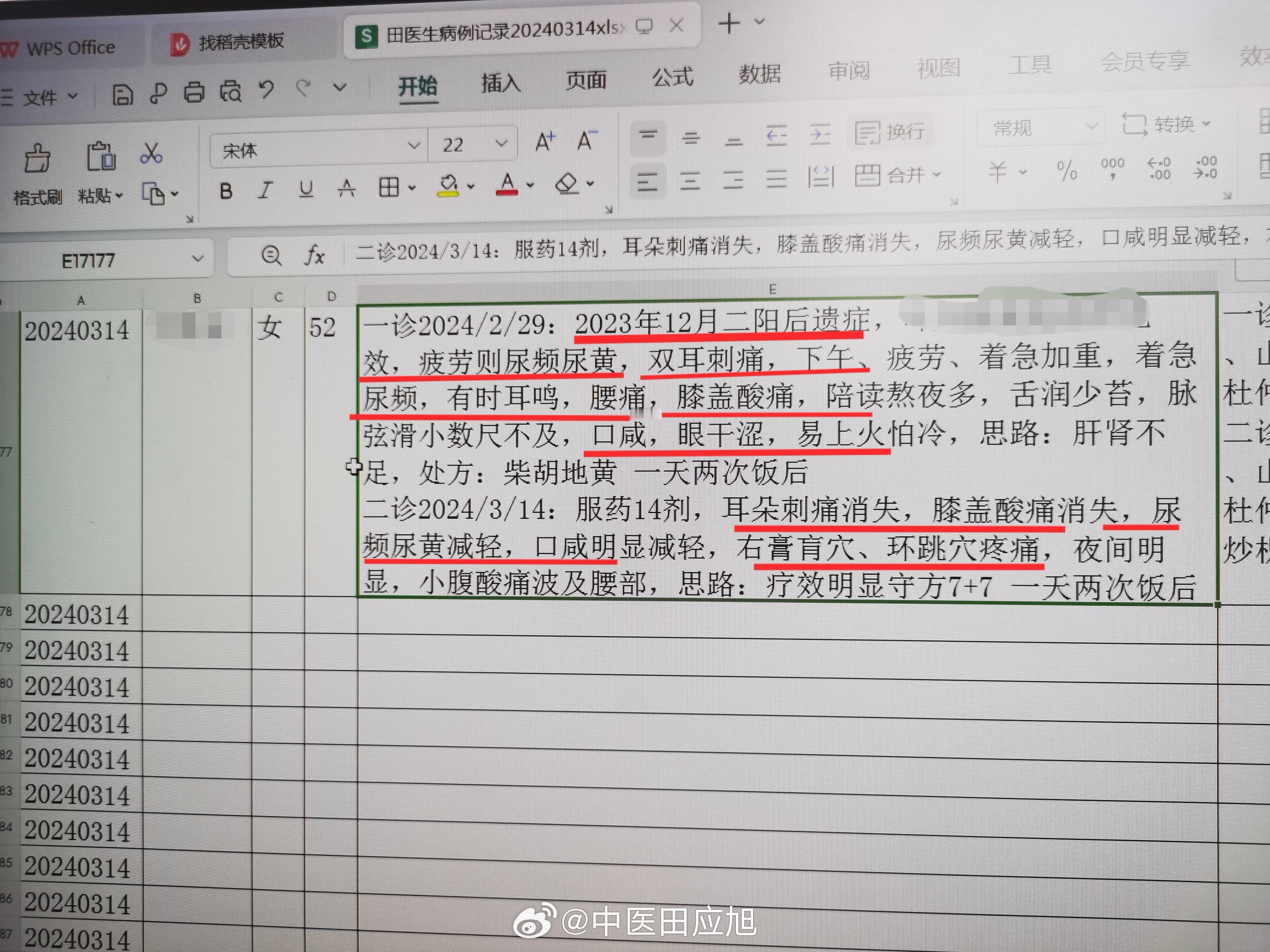 #中医##新冠后遗症#  二阳后出现新冠后遗症的陪读妈妈，女 52岁，症状挺奇怪