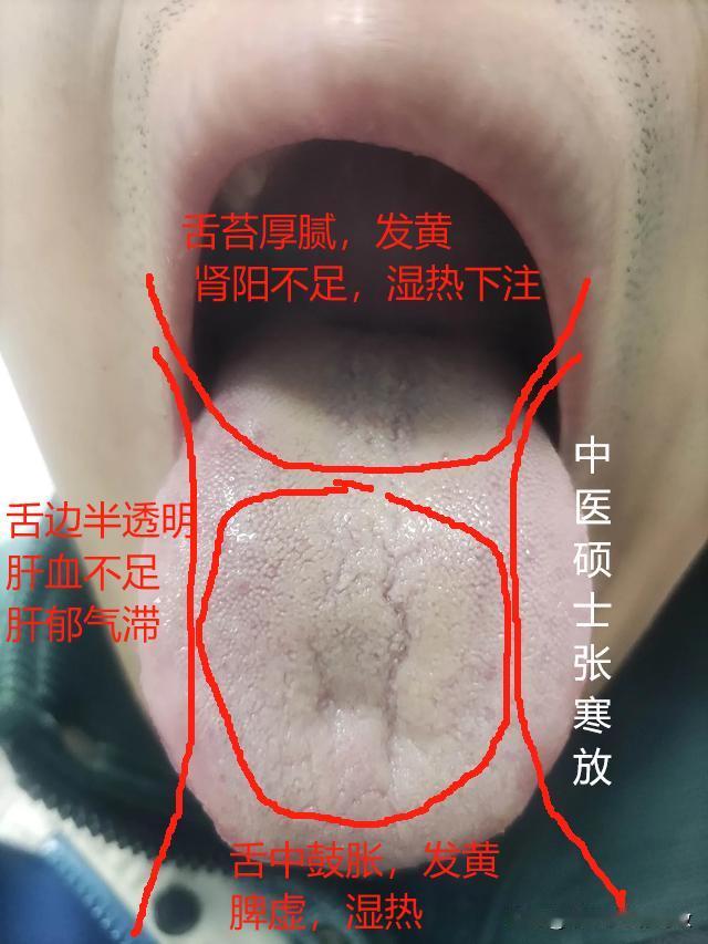 身体造成这样，真是一点一点拖出来的，自己身体自己都不上心[作揖][作揖][作揖]