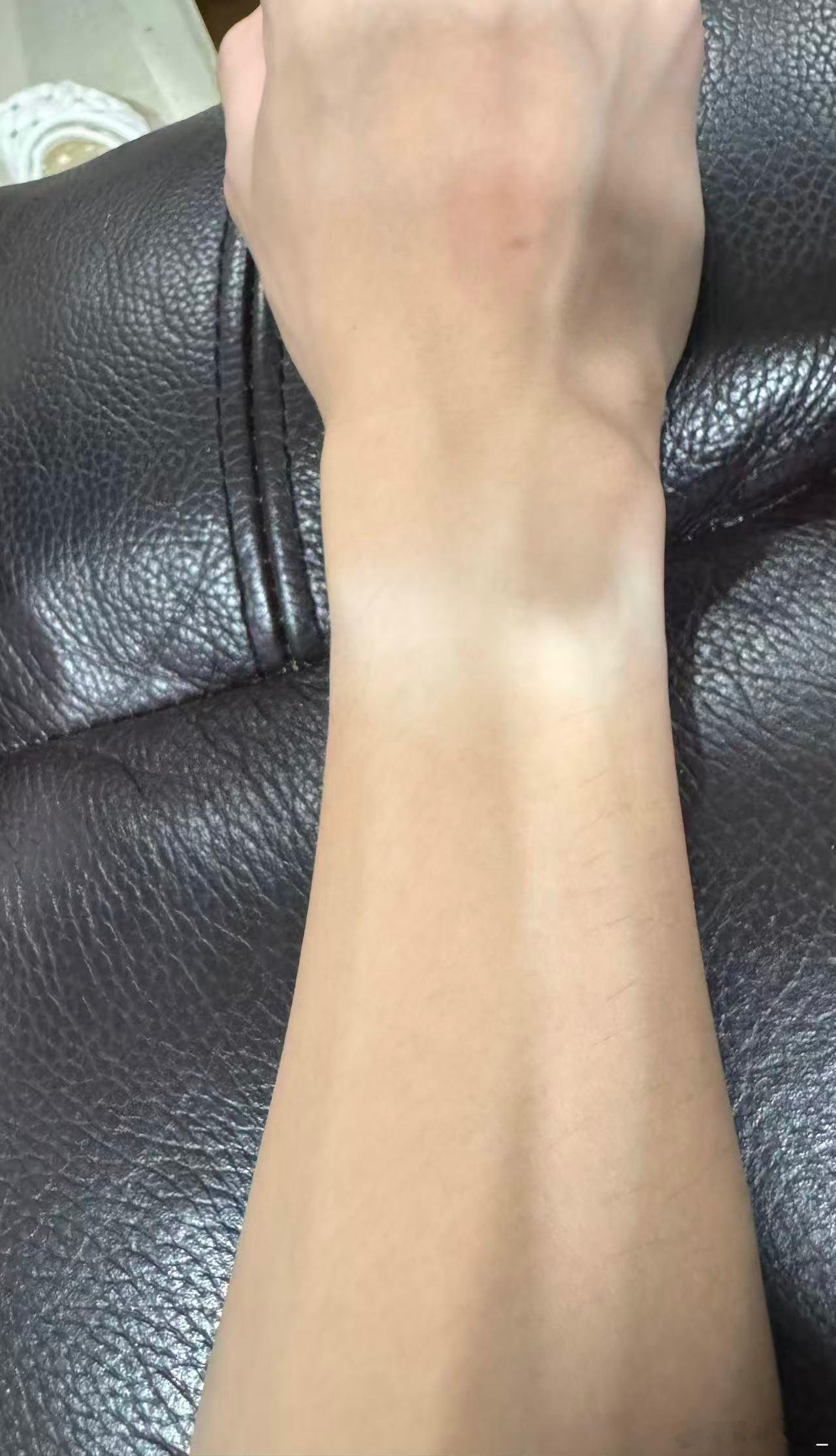 你们不是好奇我的手夏天是不是也两个色么，看，夏天才开始就已经色差很明显了…