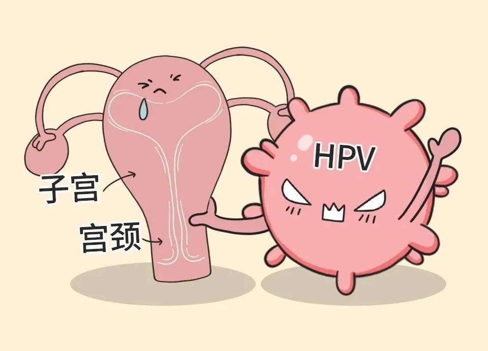 #健康真探社#【感染HPV后，这些点一定要注意！】近年来宫颈癌疫苗引起了很多关注