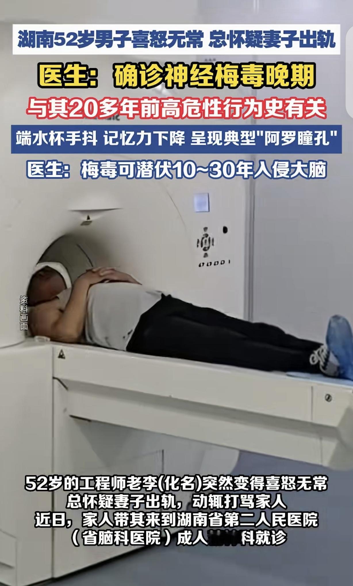 湖南，一名 52 岁男子性情突然大变，整日无端怀疑妻子出轨，初期被诊断为偏执型精