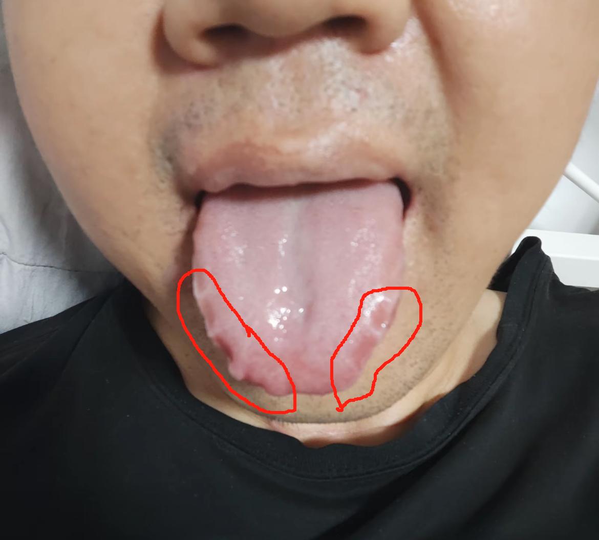 25岁小伙子，经历很丰富啊！属于老司机了
一旦出现这样的舌边，那你晚上，肯定没干