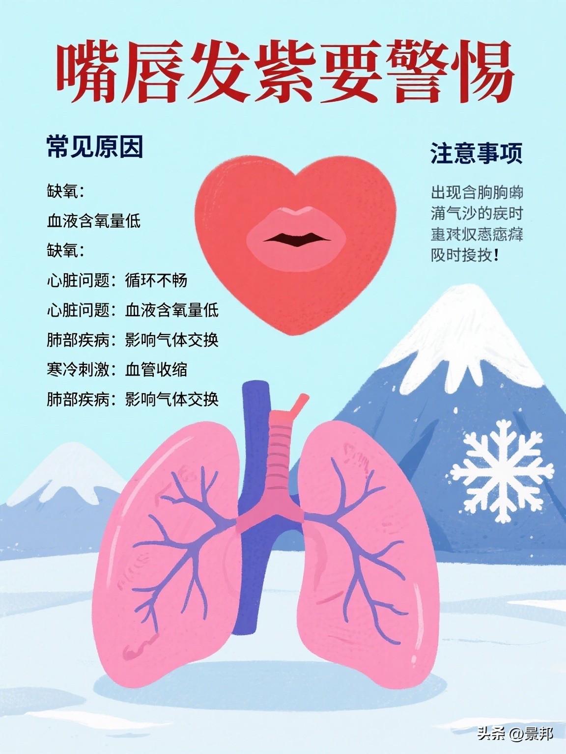 嘴唇发紫（紫绀）是一个需要高度重视的症状，它可能预示着身体缺氧或循环系统出现问题