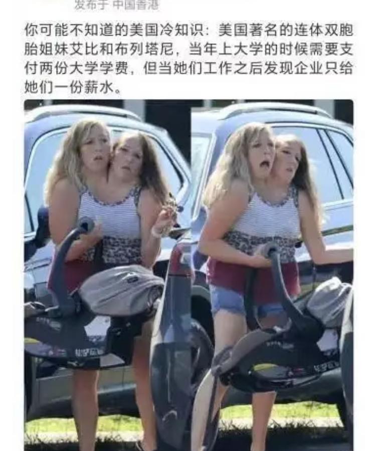 美国连体双胞胎姐妹上学时支付两份学费，工作后却只有一份薪水，虽然她们共用一个身体