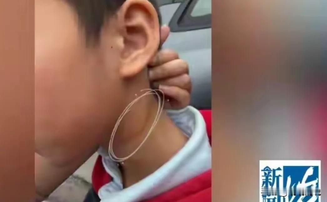 7岁娃看病怕检查，竟遭医生掐脖扇脸，院方态度更让人怒！
 
    谁能想到，带