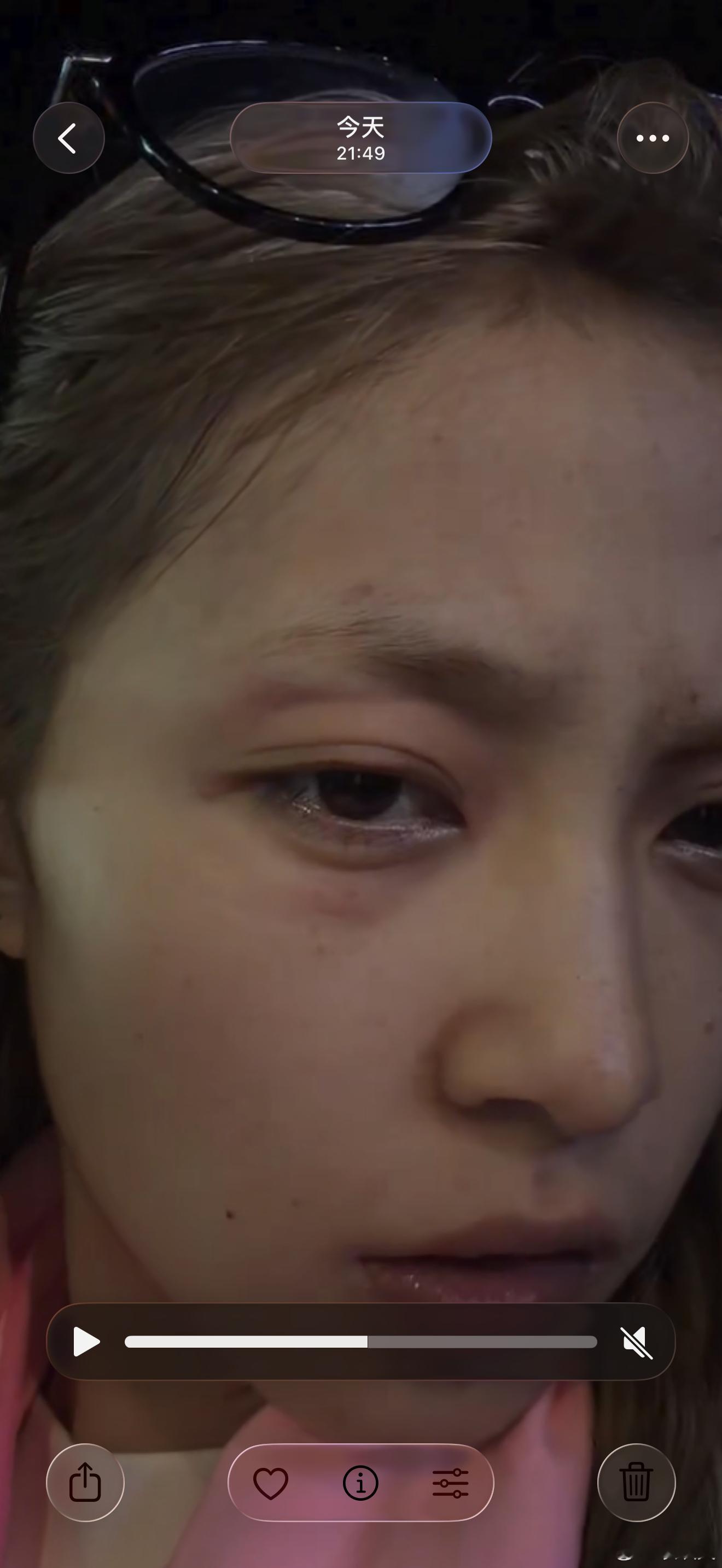 我再也不说我命苦了  早上以为是水肿结果刚刚洗个澡洗着洗着感觉眼睛睁不开了 难道