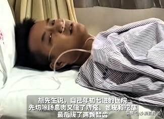 “真是个狠人！”辽宁，29岁男子一周连做5场手术，在先切除肠肌肉，又割了痔疮包皮