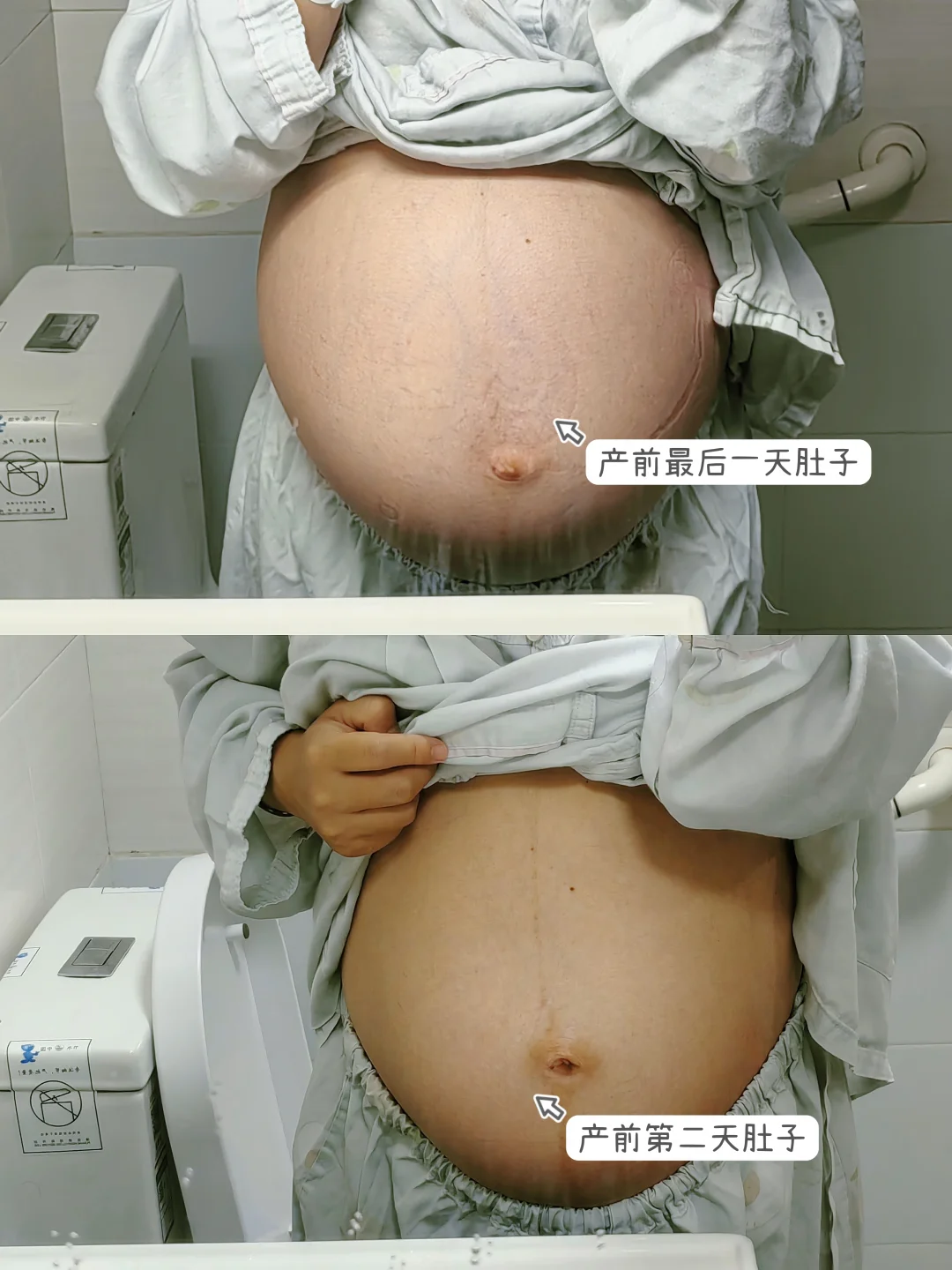 顺产第2天肚子，大家肚子都是多久平下去？