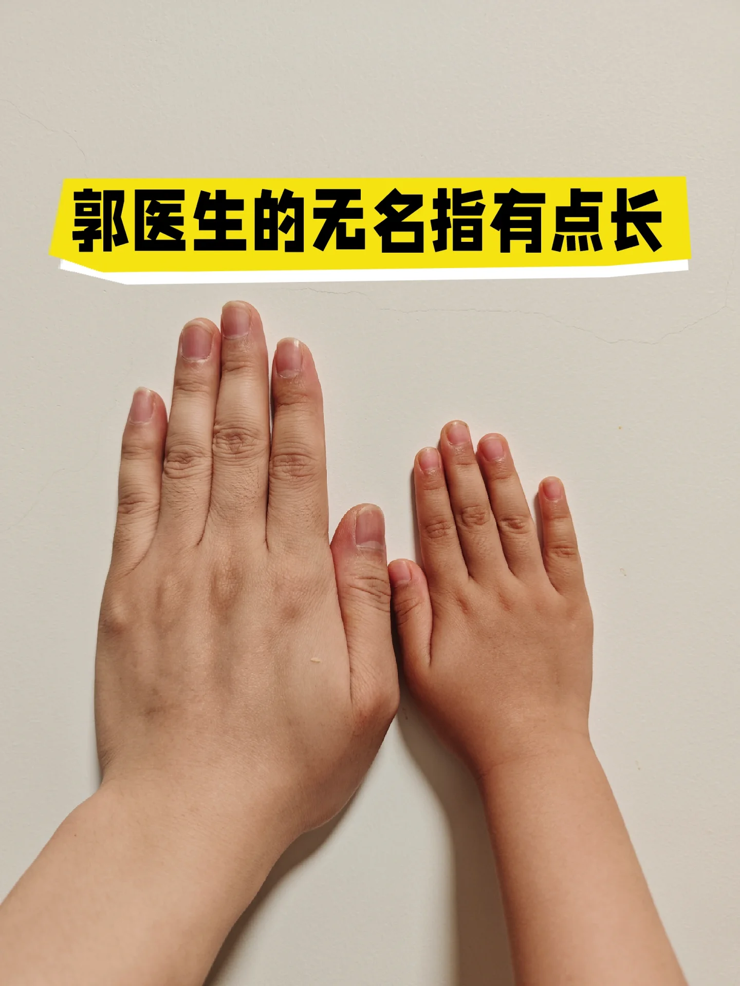 有多少人跟我一样，无名指比食指长一截
