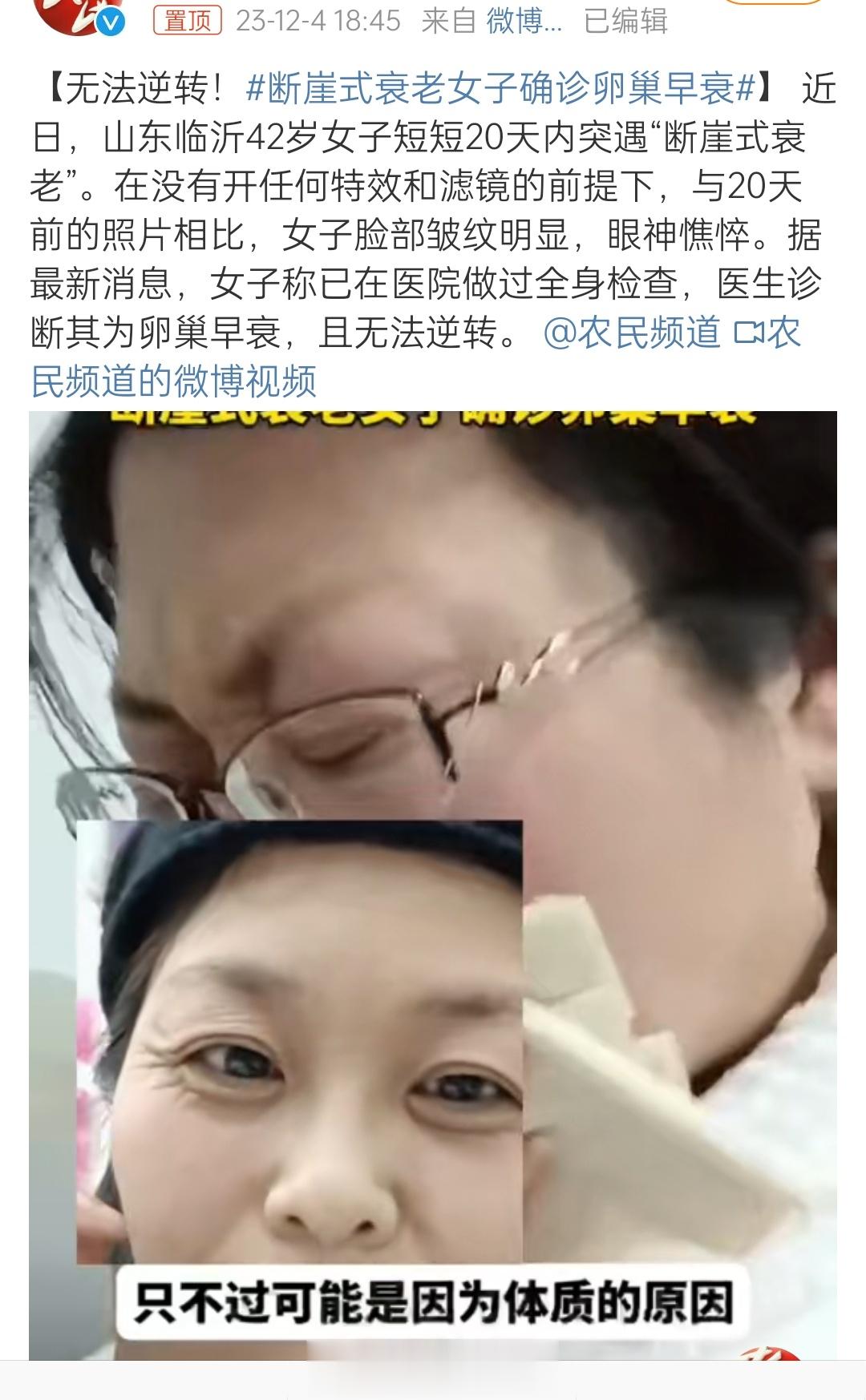 【#断崖式衰老女子确诊卵巢早衰#】有的女性就是在Ds资本的谎言里，信奉而且打蜥蜴