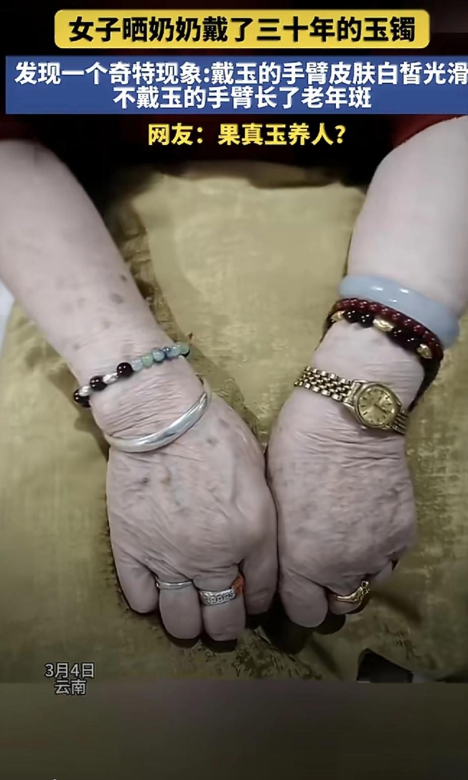 玉真的养人吗？我看是因为右手经常炒菜会被油溅到！我仔细对比了自己的双手，确实是左