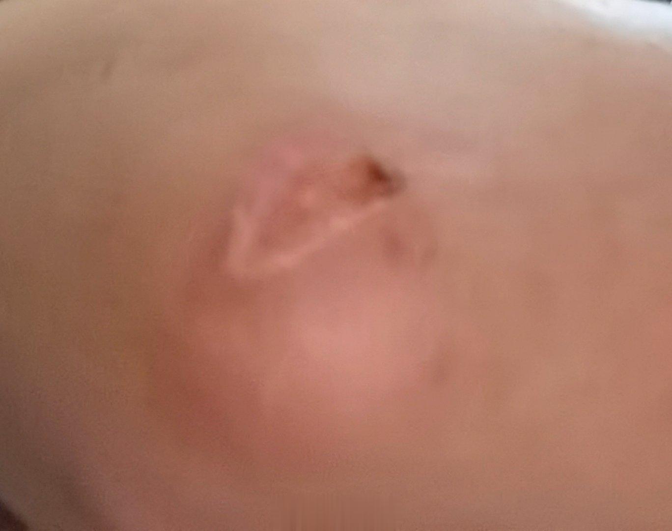 真心不容易，伤口终于开始愈合了[努力] ​​​