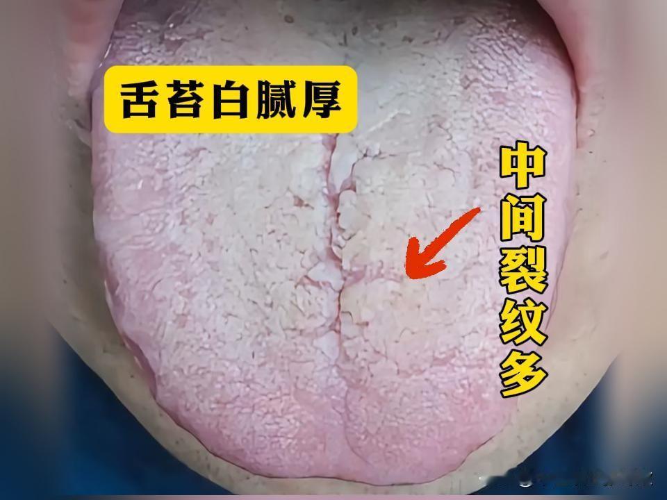杭州35岁，苏先生，这都多大了，还是管不住手[捂脸][捂脸][捂脸]
最近明显感