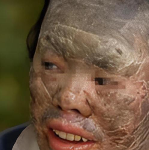 吃蛇太多变蛇人？2003年辽宁省，村民韩永波有个特殊的爱好——爱吃蛇，不仅顿顿有