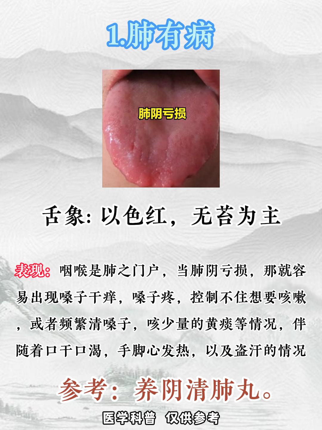 嗓子干，嗓子痒，嗓子总有痰？不一定是咽炎，很可能是这3种病！#中医##科普##涨