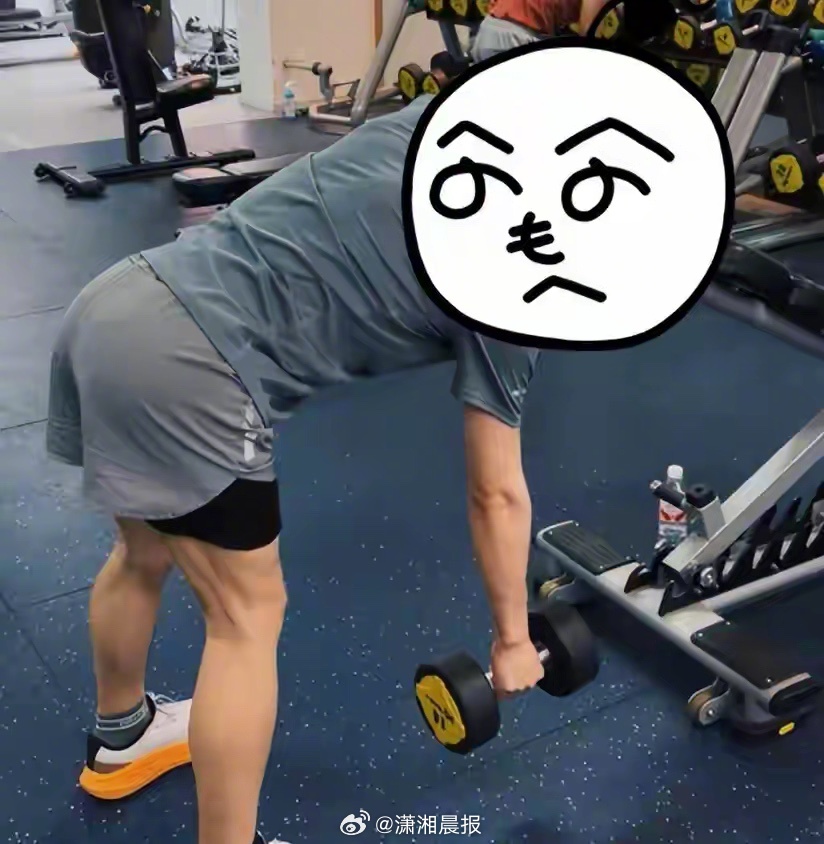 【#小伙以为增肌成功结果是胸部发育#，确诊泌乳素型垂体微腺瘤】杭州32岁的小林（
