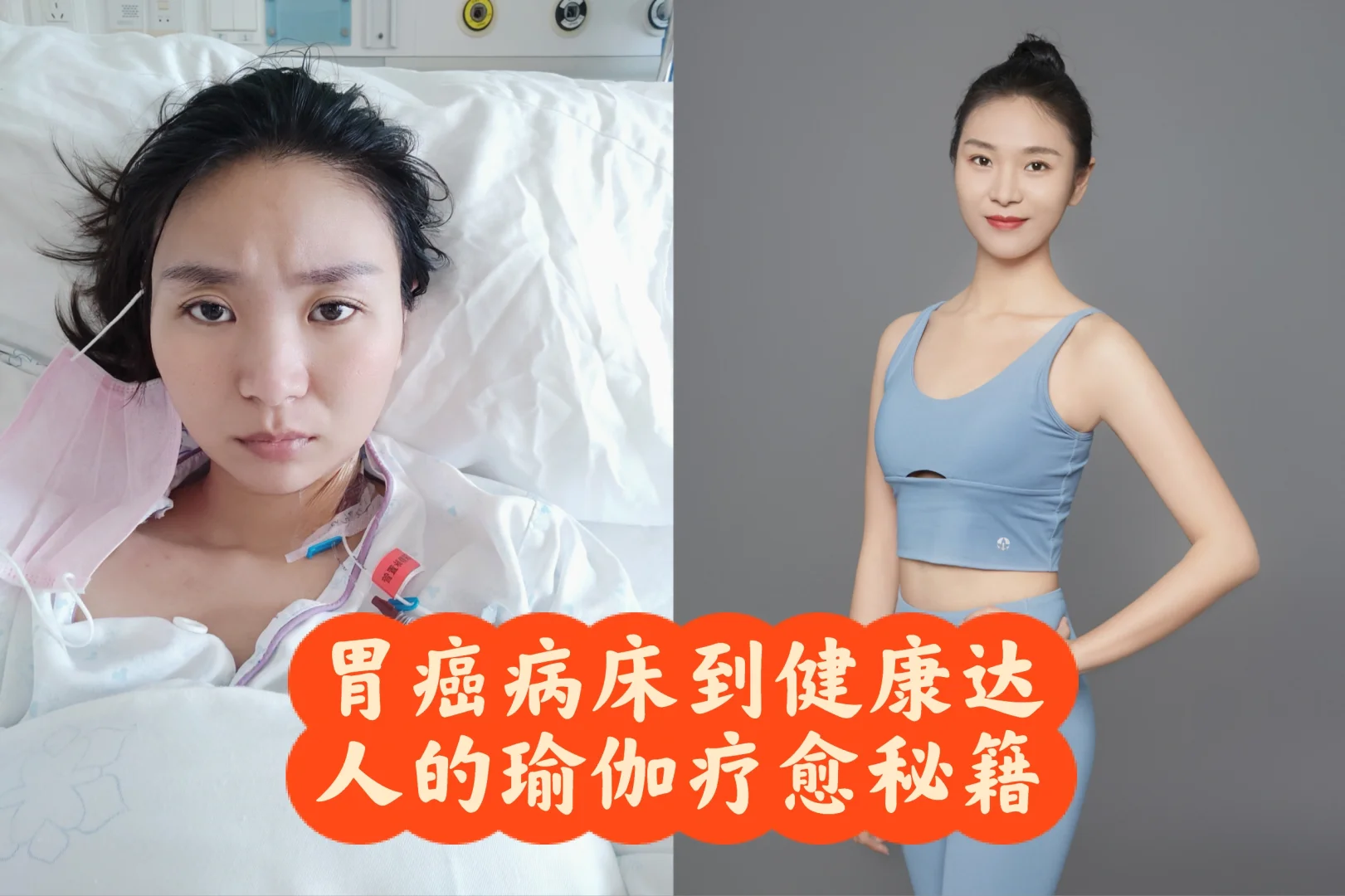 五年抗癌重生｜把生存率变成生存力