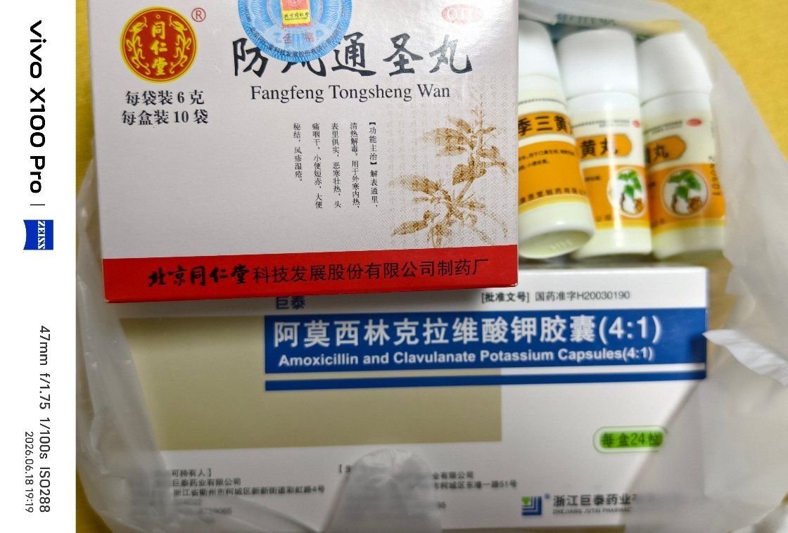 昨天开始觉得口腔右脸不太舒服我以为是牙齿发炎了但看着没毛病用了漱口水依旧是不太对