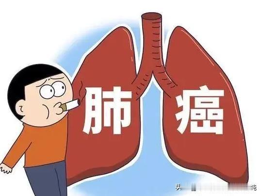 中晚期肺癌，并不是束手无策，补益整体很重要！
大家好，我是中医刘博纯！
对于中晚