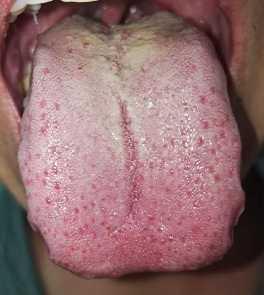 调理机能不振古方：养心固肾，强筋固本







从中医的角度看男同志出现了阳