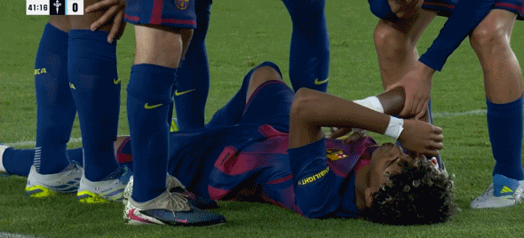 巴萨官方：亚马尔左腿股二头肌受伤，赛季报销但能赶上世界杯亚马尔将伤缺4-6周，无