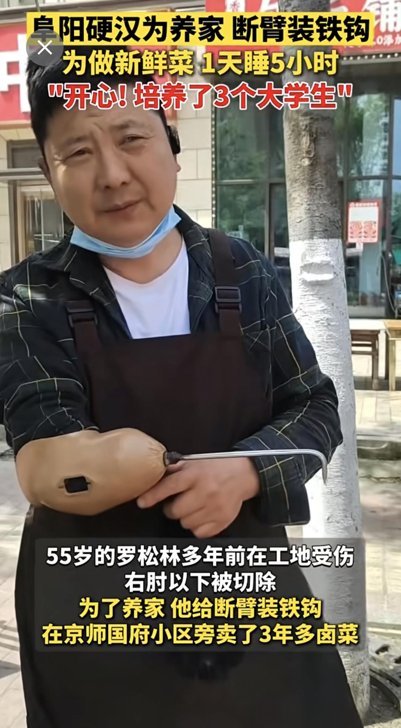 4月9日报道 安徽阜阳，在工地受伤右臂残缺，硬汉为养家，断臂装铁钩，为做新鲜菜，