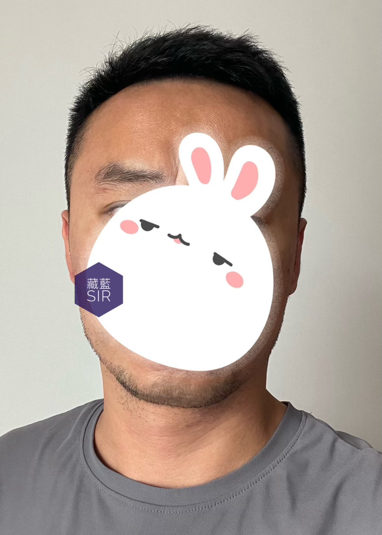 我好适合这个🤨表情瞬间变身破碎感黑黄皮胡茬小SHU