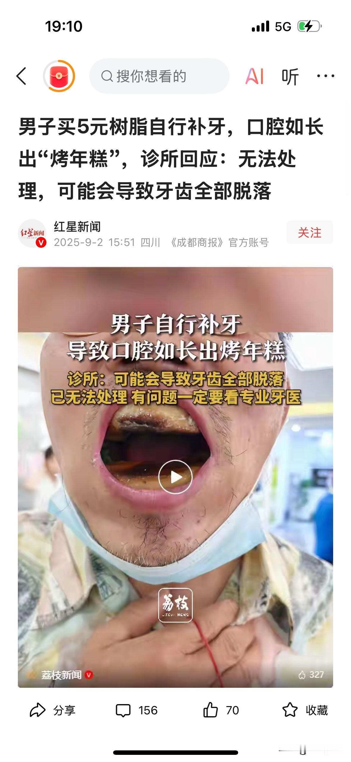 男子买5元树脂自行补牙，口腔如长出“烤年糕”。引发网友留言：
1、我给我爸爸治牙