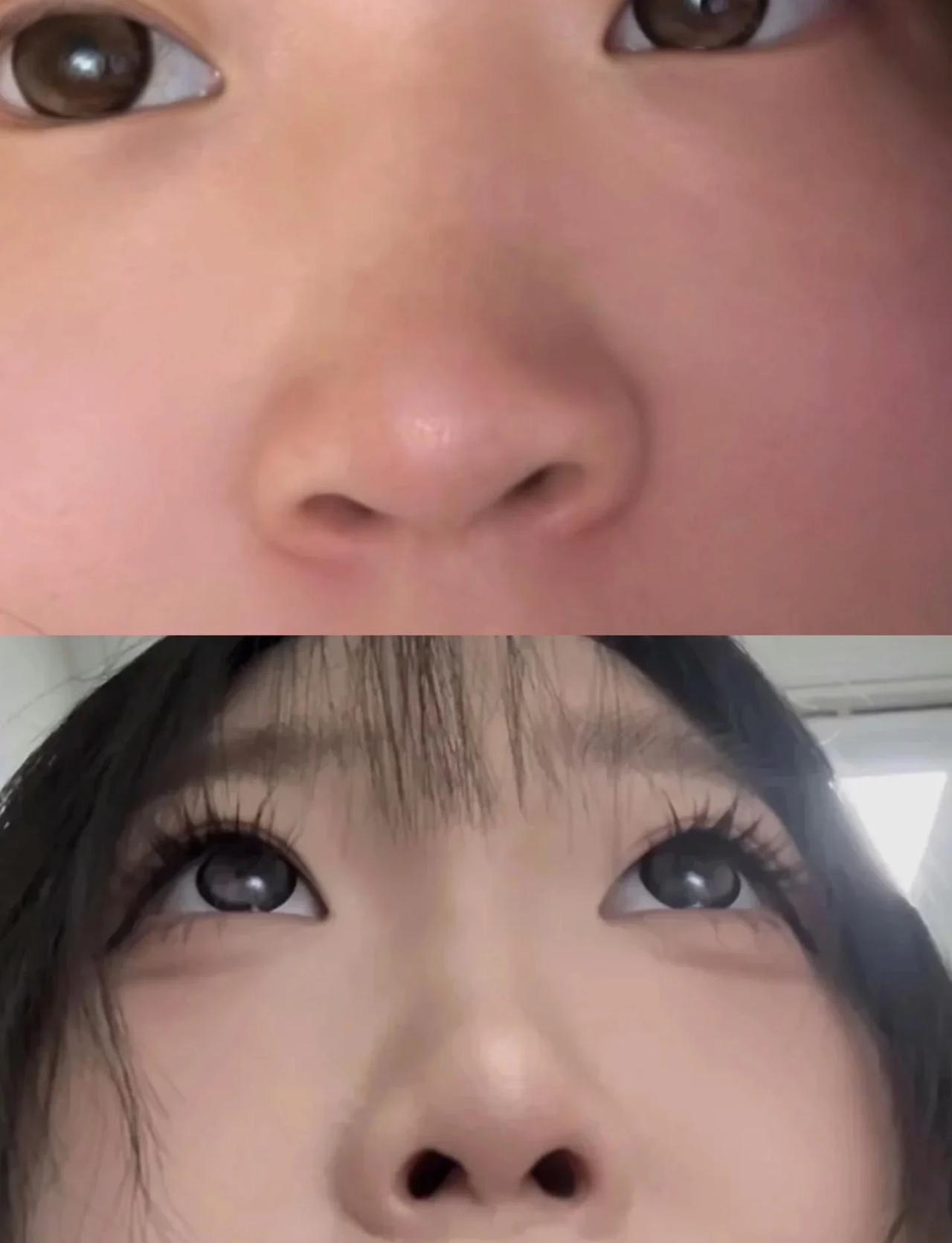 也是得到了圆圆鼻孔
从小就好想得到圆圆的鼻孔，以后咱也是可以抬起头做人了哈哈有点