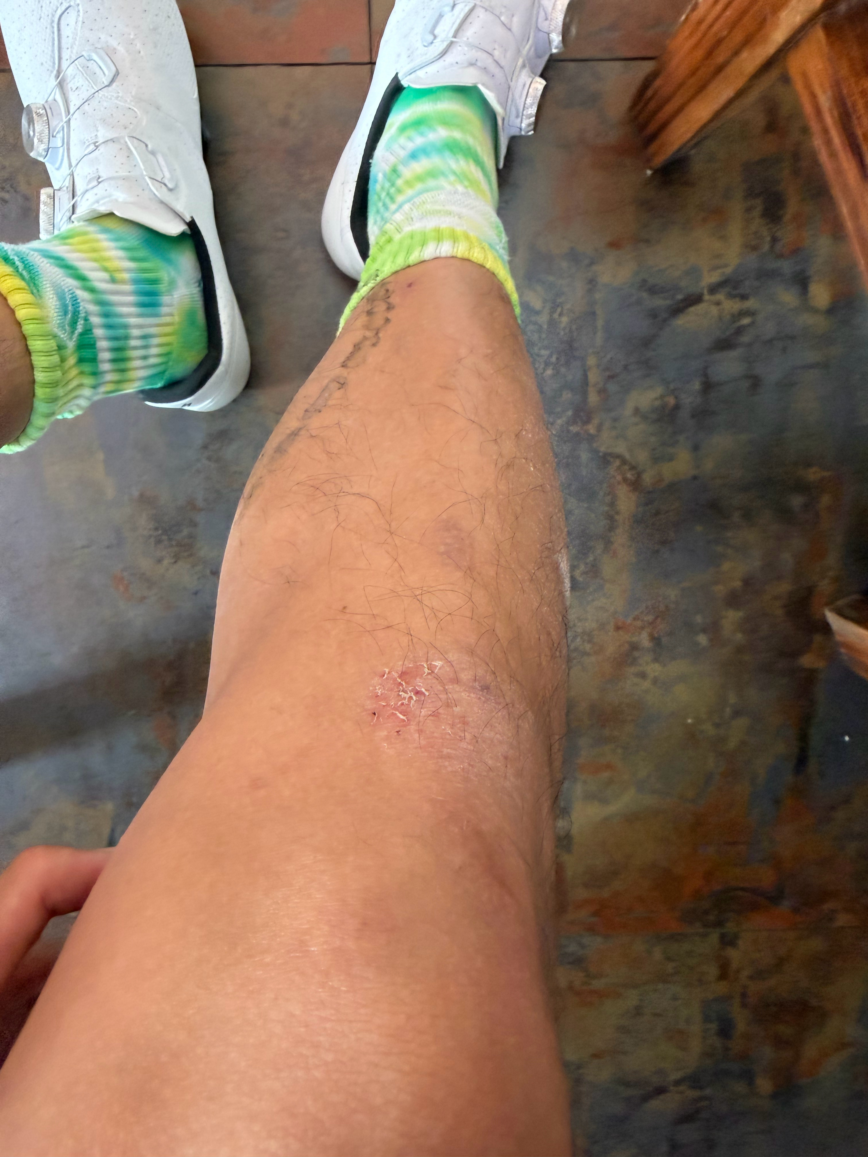 众目睽睽下喜提第一次零速摔车 佛山