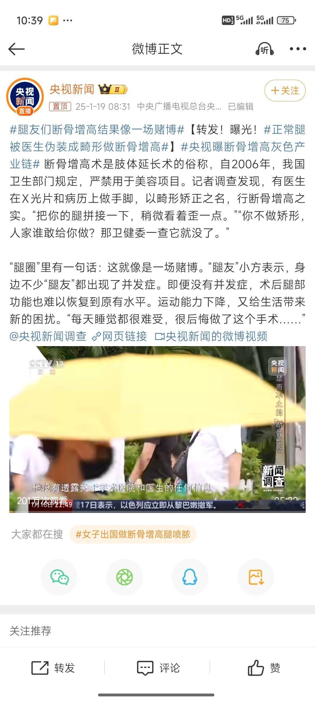 正常腿被医生伪装成畸形做断骨增高 看了这个新闻感觉腿疼……我186cm，倒是没有