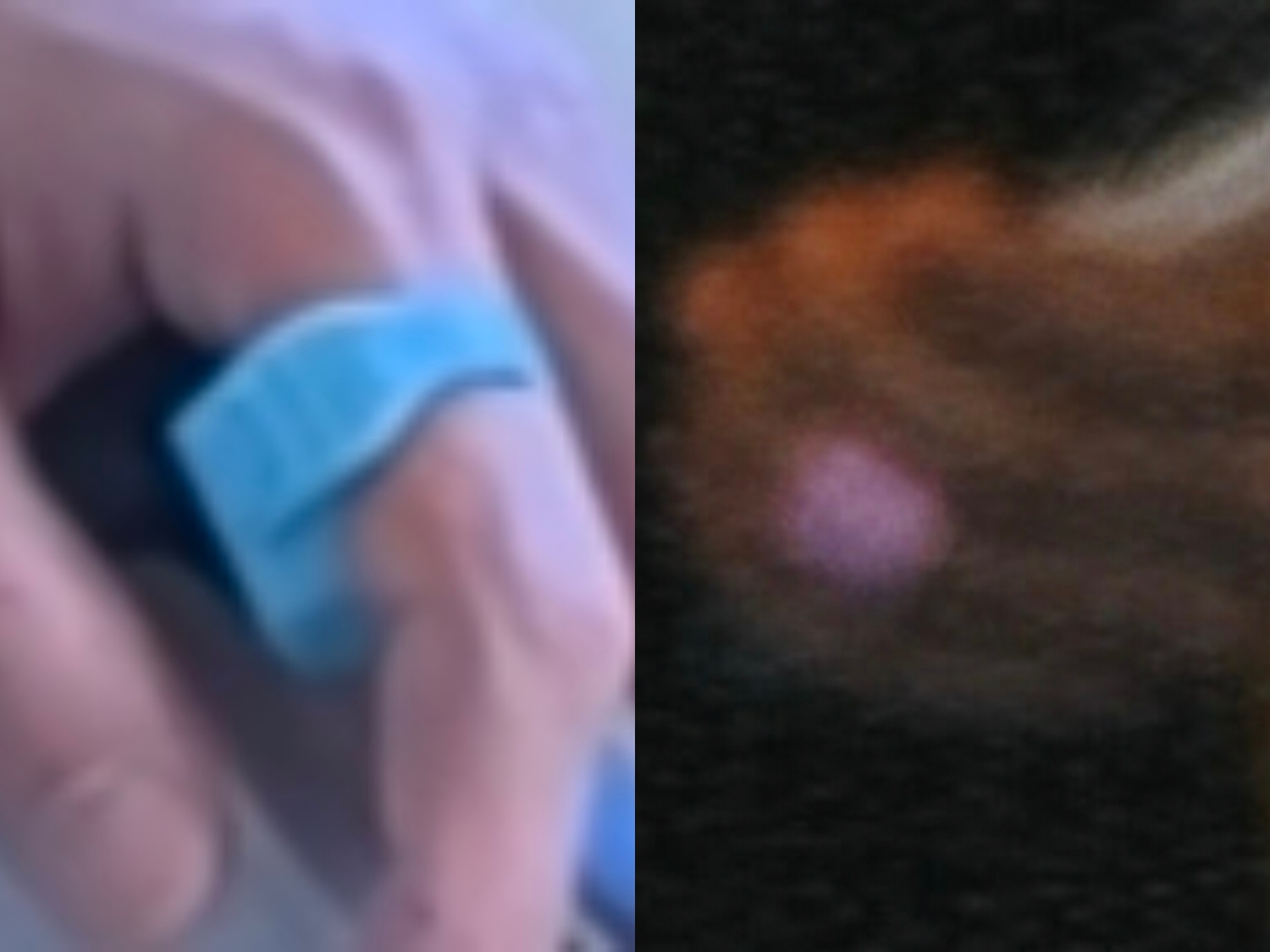 等一下，刷地瓜说我爸手上戴了个计数器，你们看看是不是……（也有说可能创口贴） 