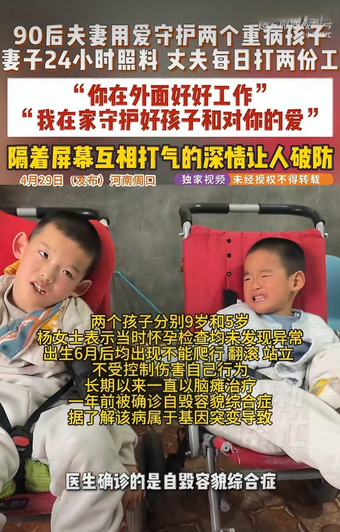 在河南周口，有一对90后夫妻，他们的两个孩子分别9岁和5岁，都患有自毁容貌综合征