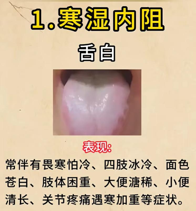 舌色发白分 4 种证型，对照舌象看懂自己的体质