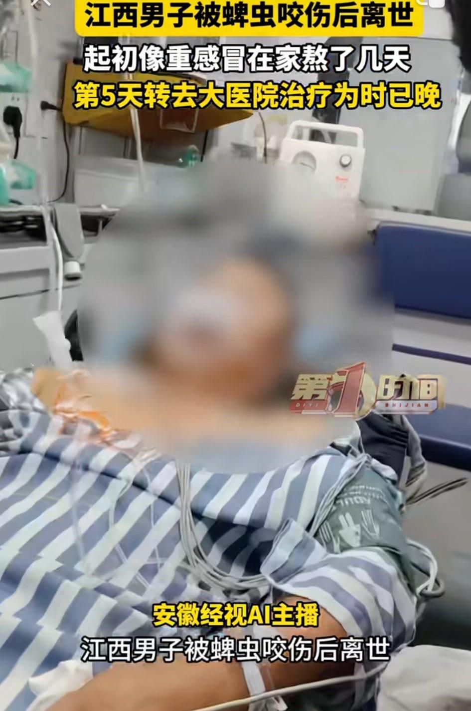 江西，一男子干活时被蜱虫叮咬后，直接拔掉蜱虫导致伤口感染，起初男子已经出现像重感