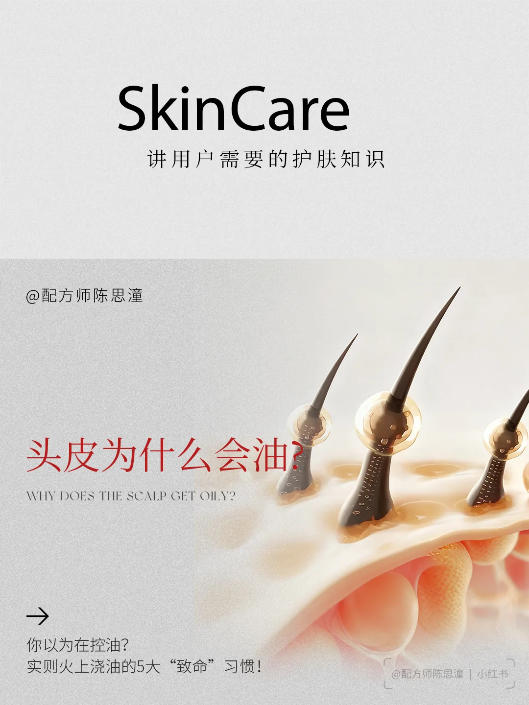 护肤知识｜刚洗的头下午就油？别只怪洗发水