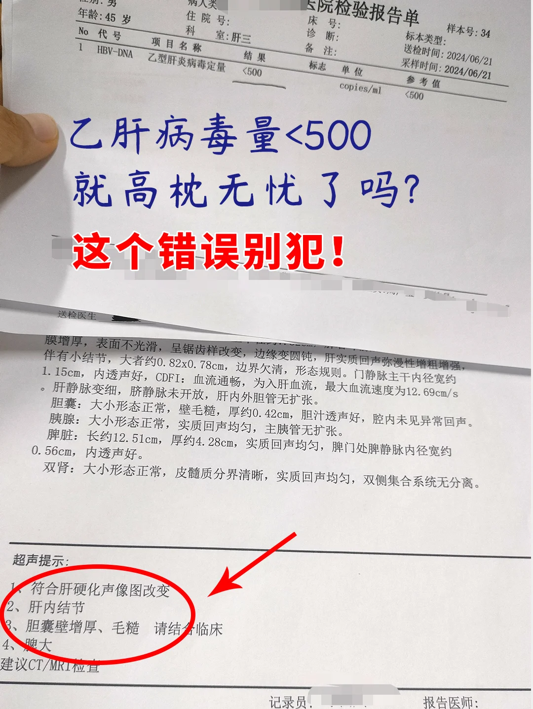 乙肝病毒量<500就安全了吗？这个错误别犯！