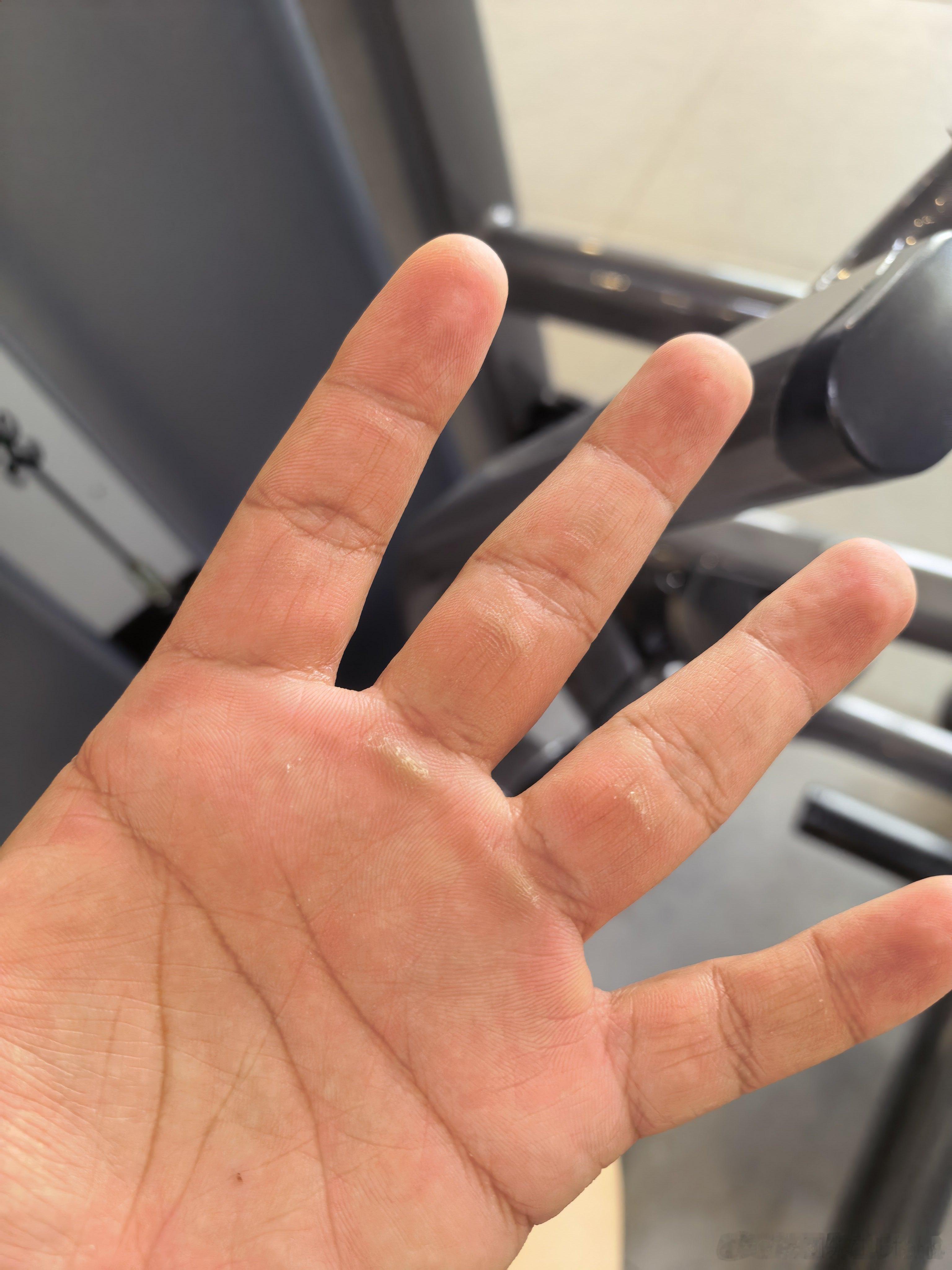 12月5日，周五！2025年，第121次打卡！问个问题，手上炼出茧了，怎么办..