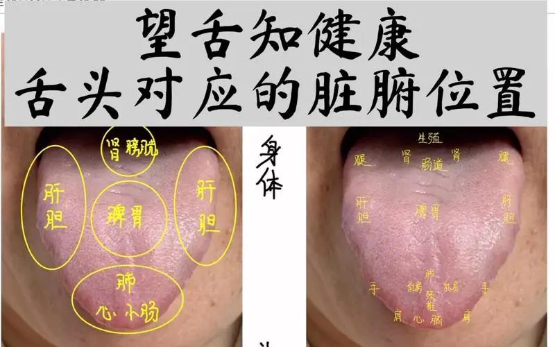 中医不是根据舌苔来开方的
经常有朋友问我能不能看舌像直接开方，这个问题我只能说我