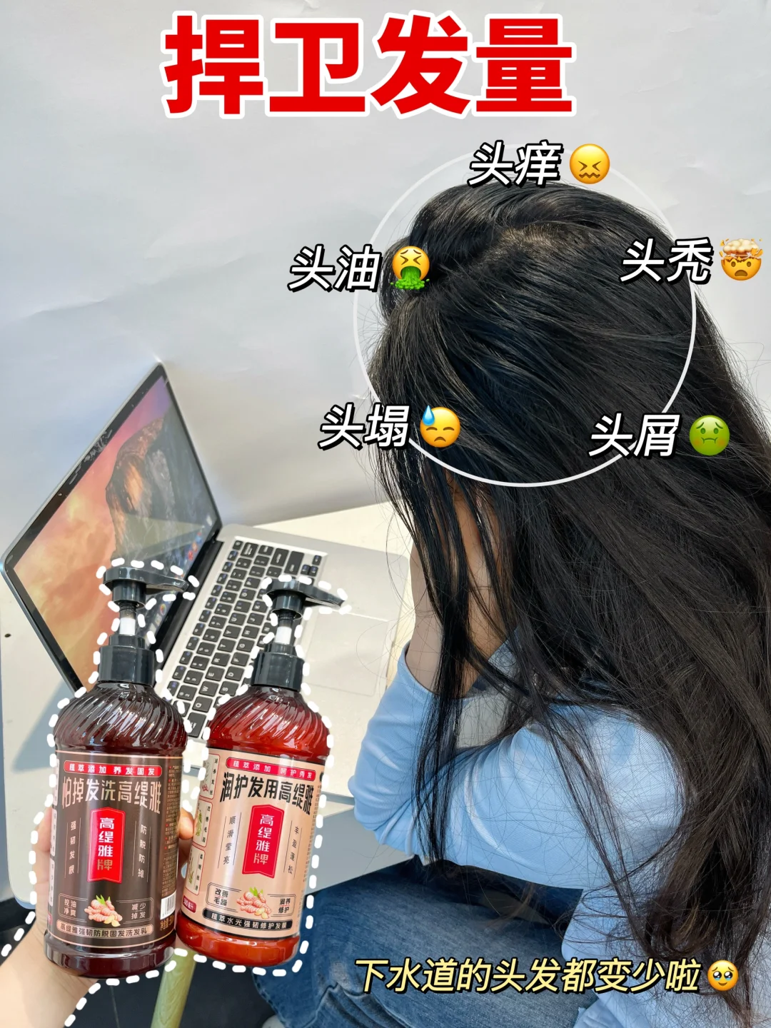 秃头油塌的别划走❗️替你们试过了真有用‼️