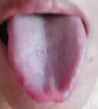 肝气郁结 + 湿气重，难怪状态差！这样调理更靠谱






很多朋友一旦出现了