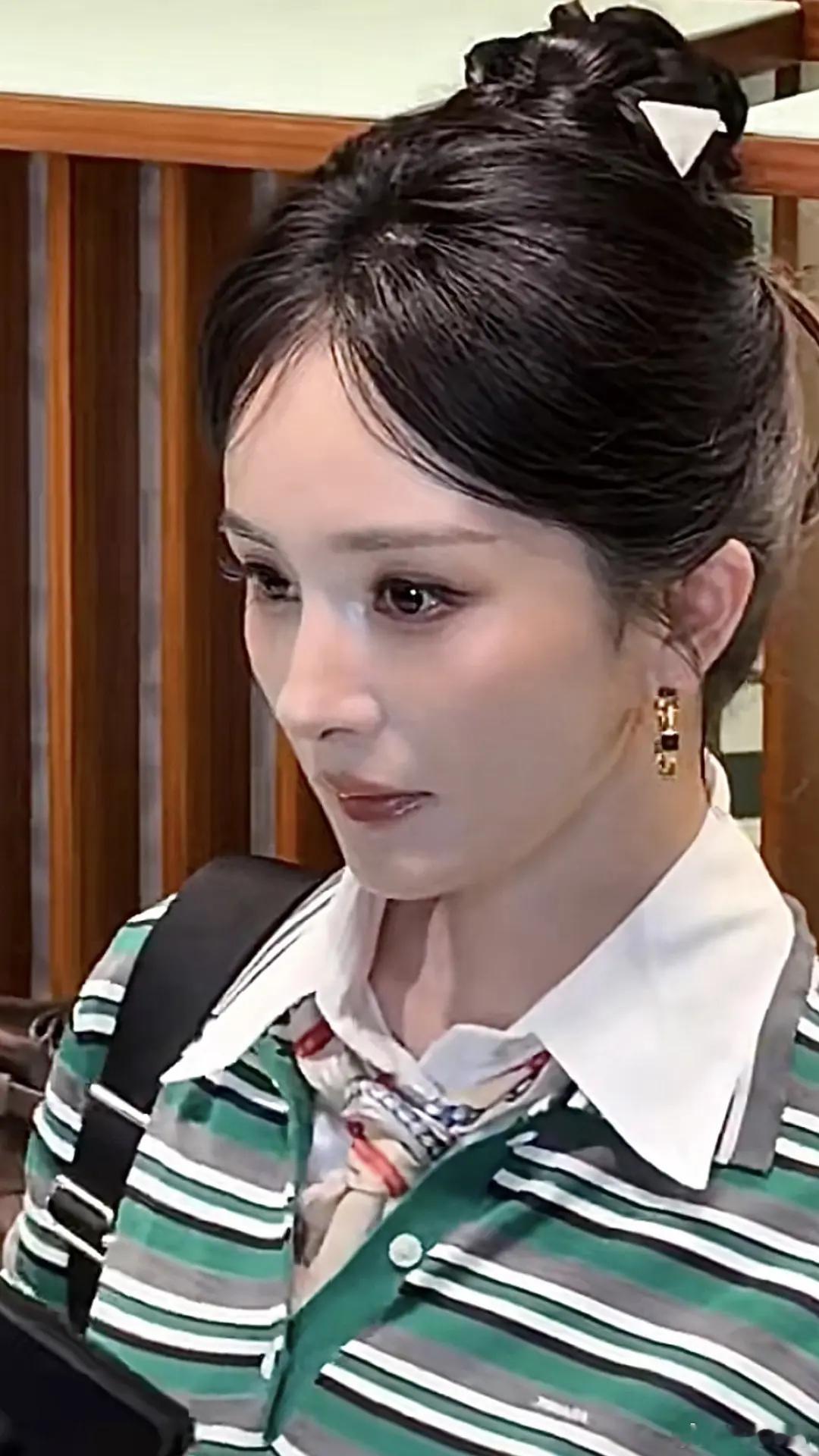 杨幂：别低头下巴假体要掉 