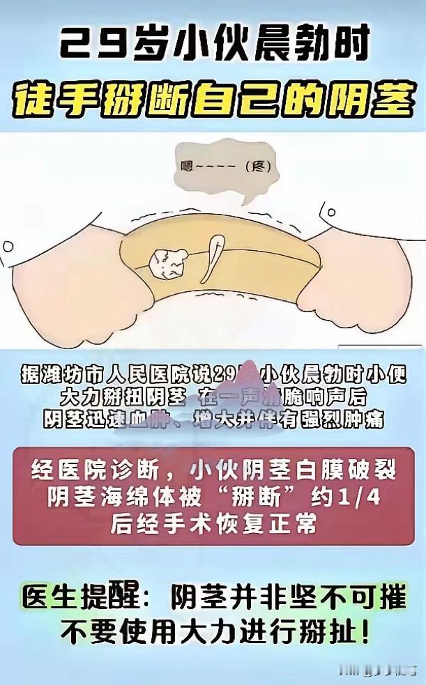 潍坊一小伙子晨勃的时候，徒手掰断自己的阴痉！

看到这个新闻，这真是让我呆若木鸡