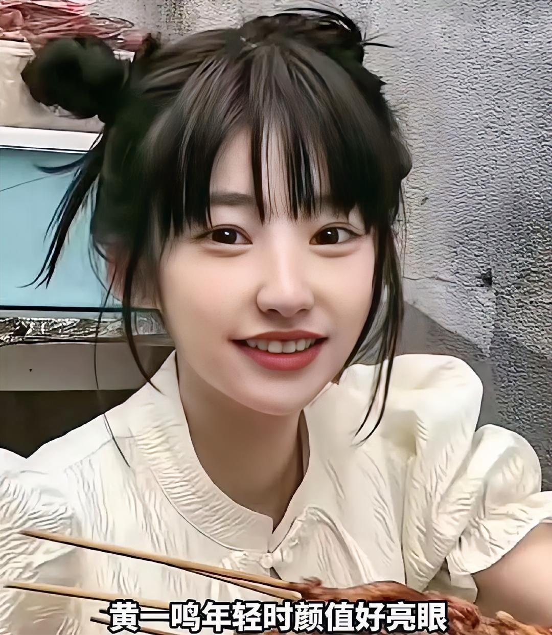 黄一鸣这下巴整得，居然敢直接晒成果？
 
大方分享整后状态，直言下颌线更明显、侧