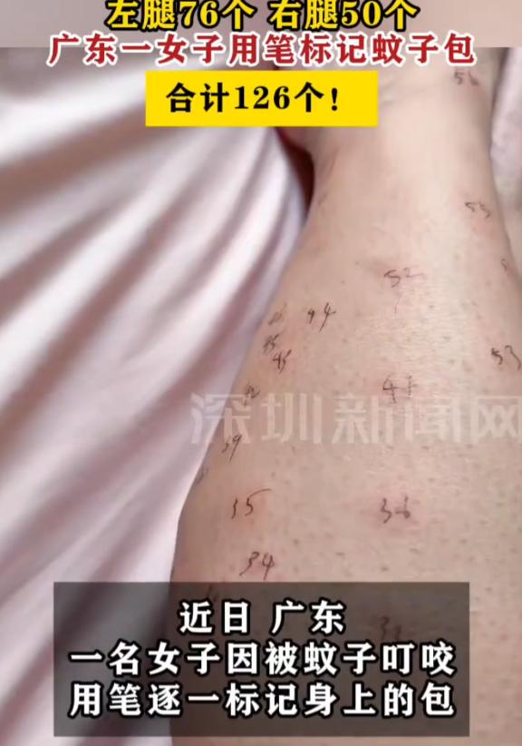 这是开蚊子养殖场？广东一名女子夜间睡觉忘了关窗，屋内涌入大量蚊子，睡醒后双腿布满