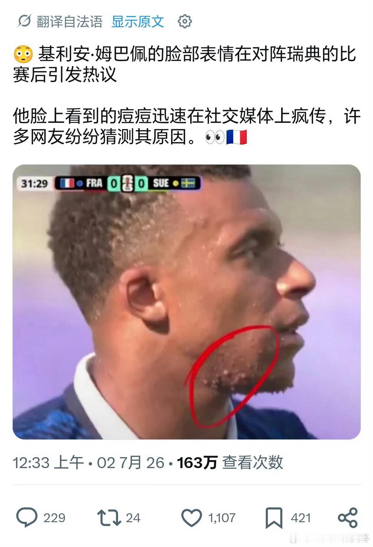 姆巴佩的脸怎么了世界杯在2026年世界杯法国对阵瑞典的比赛中，转播镜头精准捕捉到