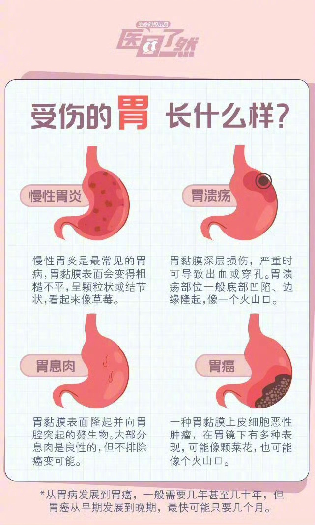 【#胃病向胃癌发展有5个征兆#】#医生说男性胃癌更高发# #雷宇扬去世#据港媒，